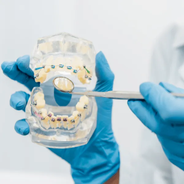 Pendik Yetişkin Ortodonti Tedavisi: Diş Teliyle Mükemmel Hizalanmış Dişler