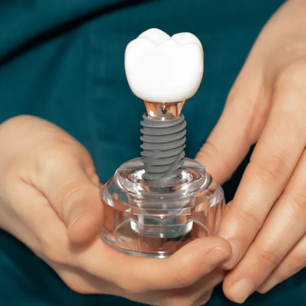 Kartal Diş İmplantı Tedavisi Eksiksiz Gülüşünüzü Geri Kazanmanın En Etkili Yolu